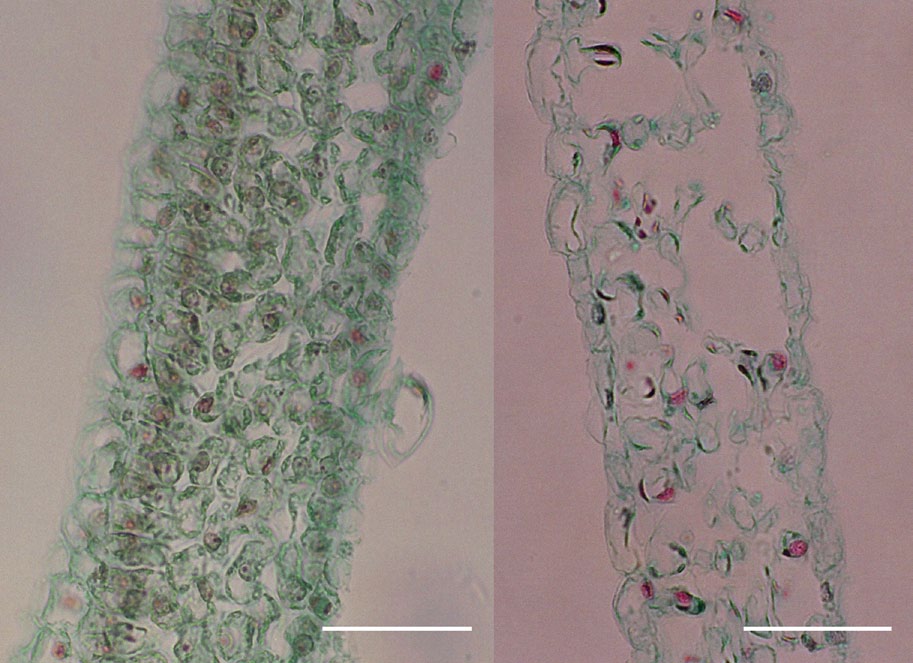 Magnified photos of a green bract and a white bract.